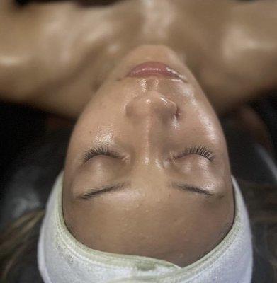 Facial treatment