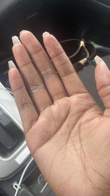 How they left her nails after the incomplete refund and soak off of their bad work.