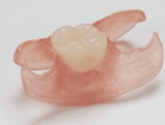 partial denture