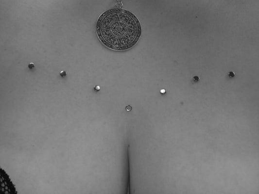 Myke Dermal Anchors