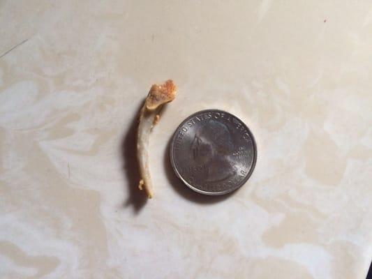 Bone from my chicken sandwich that I bit into and stabbed me in the cheek.