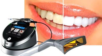 Our in office Laser Whitening!  Ask about our specials!