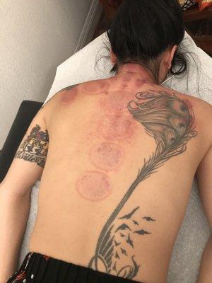 Gua sha