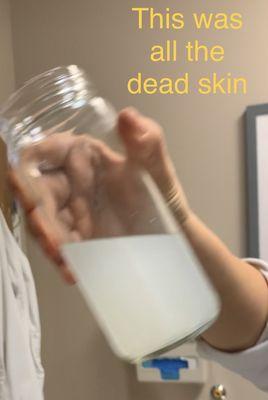 Dead skin cells