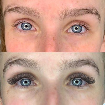 Hybrid Fill Set: before & after