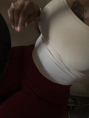 Tummy tuck 1 month post op