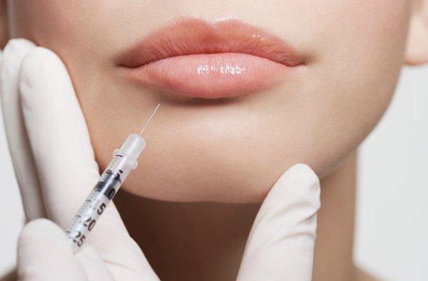 Want plump lips, call Ida to schedule