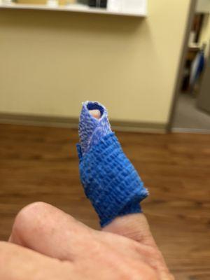 Bluey my splint