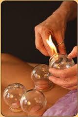 Cupping Therapy for relaxation and muscle tension relief