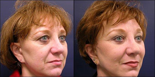 Chicago Face And Body Surgery