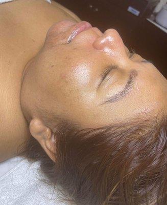 Dermaplaning Facial