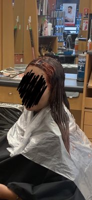 The hair dye that's all along her forehead and sides stained her skin!