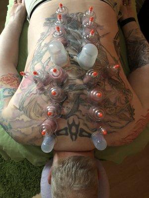 cupping