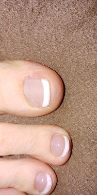 More pictures of poor french tips and nails cut too short.