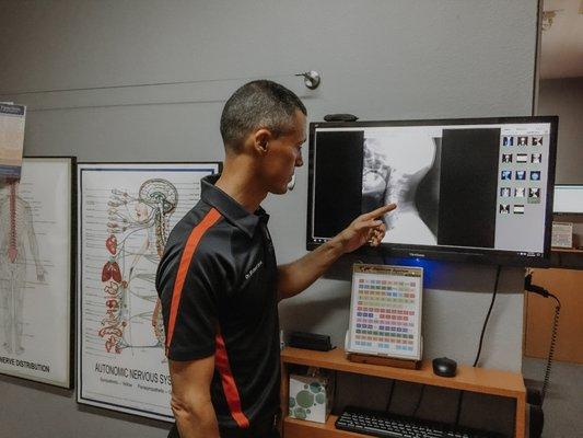 Dr. Michael Sosa going over a patient's x-ray