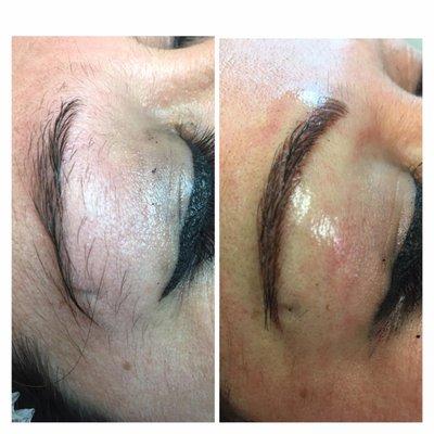 Reshaping the brow with microblading