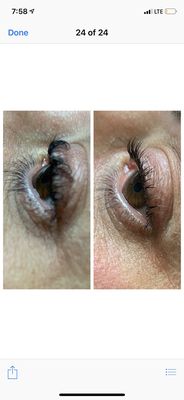 Her work (left pic) , and the corrected eye after a reversal (right).