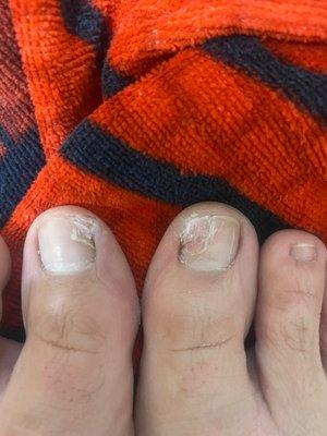 My toes after getting pedicures from Sun Nail and Spa in Dearborn