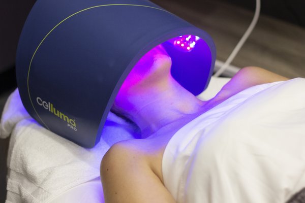 Celluma LED Treatment. FDA approved for wrinkles/anti-aging, acne, and pain relief