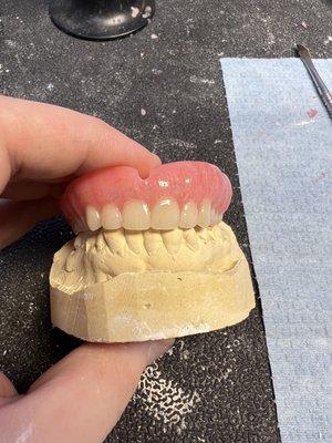 Value Upper Denture