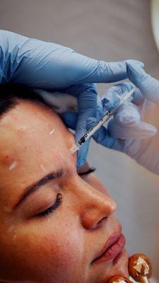 Eliminate fine lines and wrinkles with BOTOX® injectable treatment