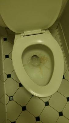 This toilet hasn't seen a scrub brush in a while.