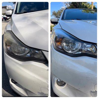 Headlight restoration