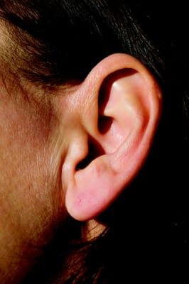 Invisible in canal hearing aids sit deep inside your ear canal so only you know you're them!