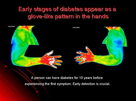 Did you know that a Full Body Thermogram can show both of those conditions before you have symptoms? Ask for a Full Body Thermogram.