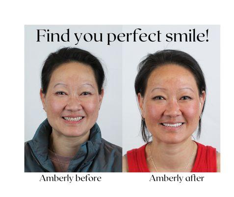 Find your perfect smile! Call 801-942-7770 for an appointment. www.whiteridgedental.com