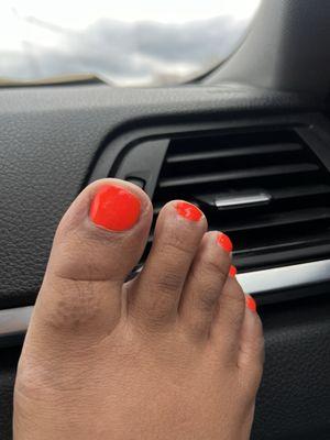 CROOKED BIG TOE FILING