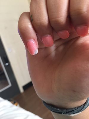 5 days later and a full chunk came off my nail