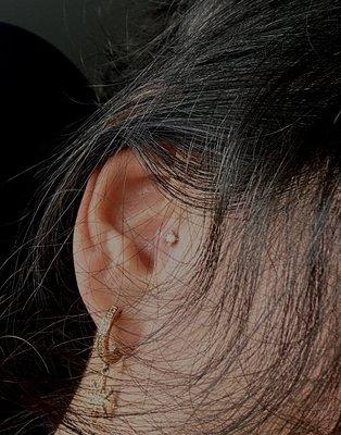 Tragus