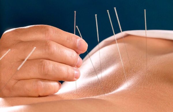 Acupuncture and other modes of Traditional Chinese Medicine improve successful conception rates by about 50% per cycle.