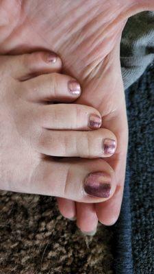 Toes