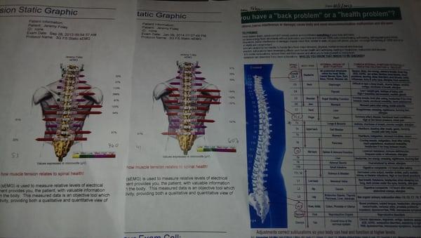 Impressive tech evidencing the results of Olympic Chiro work. My shoulders and back feel incredibly better after 12 visits.