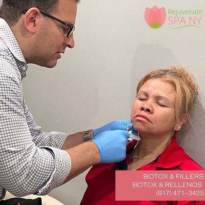 BOTOX AND FILLER BY DR. CASH