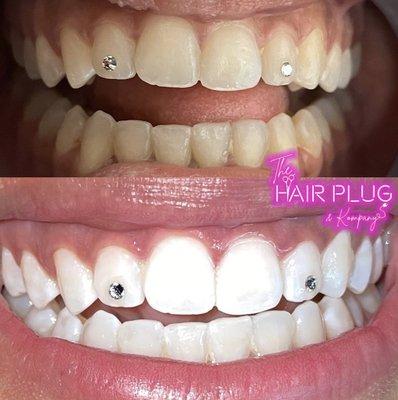 Cosmetic teeth whitening services available! Call or text for more information.