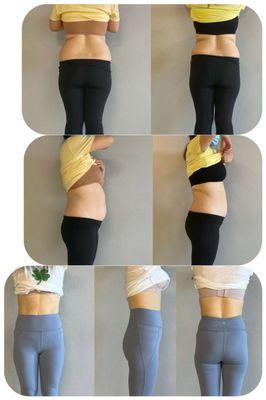 postnatal recovery excise
 amazing  result in 2.5 months!
 pelvic floor& rectus abdominols!