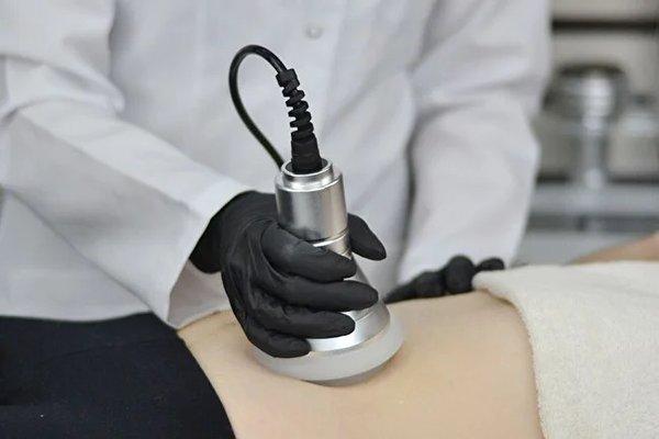 Cavitation Ultrasound for fat reduction