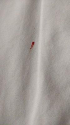 Blood on the sheets