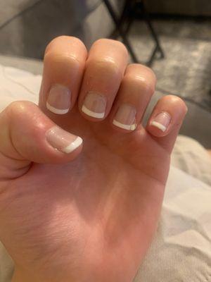 Raised nails