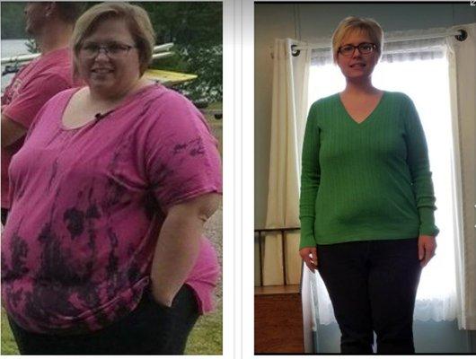 Lacey- 180 Pounds Lost