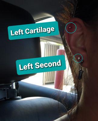 Left Cartilage 
 Left Second