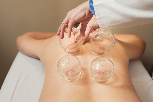 A patient receives cupping