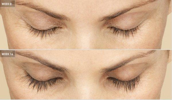 8 weeks after Latisse lash lengthening serum