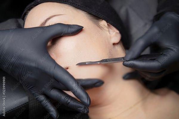 Dermaplaning Treatment