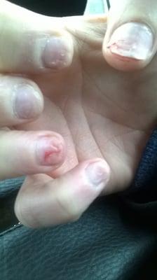 destroyed my nails