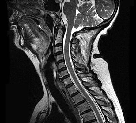 Peninsula MRI