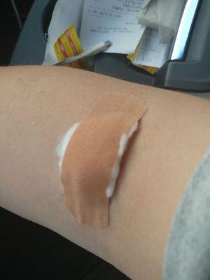 Second arm where they messed up on couldn't take the IV stay away from this place